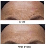 Dr. Denese SkinScience Advanced Firming Facial Pads - 100 Count — image 9