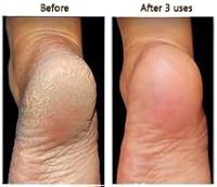 Secret of the Islands Coconut Salt Scrub 16oz — image 5