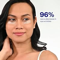 Wrinkles Schminkles Self-Dissolving Microdart Patch for Face (4 pairs) — image 3