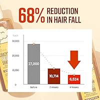 CRAZY SKIN German Beer Yeast Biotin Shampoo & Hair Treatment Set 300ml + 200ml — image 5