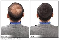 JUVEKER Hair Building Fibers 28g - Black — image 5