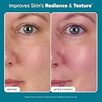 Paula's Choice SKIN BALANCING Pore-Reducing Face Toner, 8.15oz — image 5