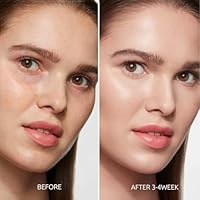 Aurivoy Dark Spot Remover Serum 1.7oz — image 3