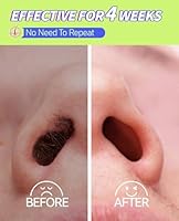 unimiko Nose Hair Wax Kit — image 5