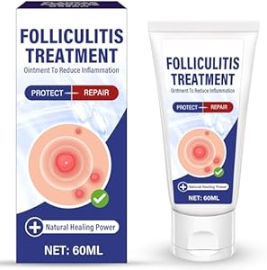 CIZHA Folliculitis Cream 60ml Review