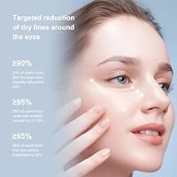 Ycz Electric Massage Eye Cream — image 3