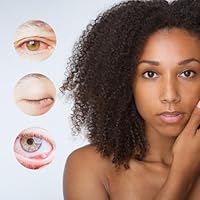 brazzoMD StyeRx Eyelid and Lash Wipes (60 Count) — image 4