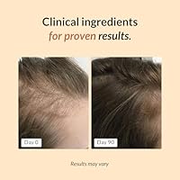 FullyVital Hair Growth Supplement for Women, 1 Month Supply — image 3