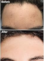 Teenology Leave-In Conditioning Detangler + Heat Protectant 6 oz. — image 4