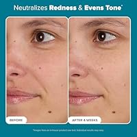 Paula's Choice SKIN BALANCING Pore-Reducing Face Toner, 8.15oz — image 4