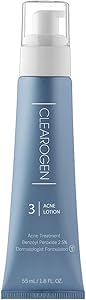 Clearogen Acne Lotion with Benzoyl Peroxide 1.8 fl oz Review