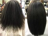 Infinix Black Rice Oil with Tea Tree – 2-Bottle Combo (2 oz Each) — image 5