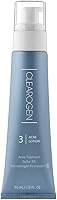 Clearogen Sensitive Skin Sulfur Acne Lotion 1.8 FL Oz — image 1