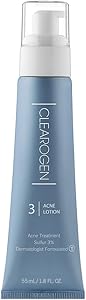 Clearogen Sensitive Skin Sulfur Acne Lotion 1.8 FL Oz Review
