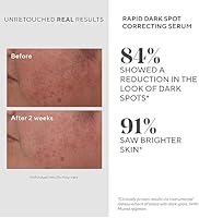 Murad Rapid Dark Spot Correcting Serum 1 Fl Oz — image 4