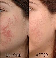 Dr. Brenner Vitamin C Serum 20% with Hyaluronic Acid & Vitamin E, 2-Pack — image 4