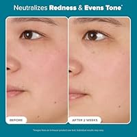 Paula's Choice SKIN BALANCING Pore-Reducing Face Toner, 8.15oz — image 3