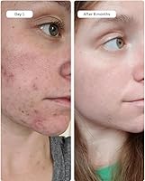 Averr Aglow Clear Skin Elixir — image 8