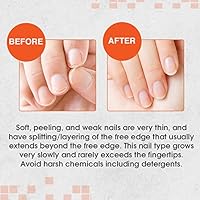 Nail Tek Intensive Therapy 2 Nail Strengthener 0.5 oz x 2-Pack — image 3