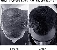 PATRICKS SH PLUS Ultra Thickening Shampoo 200mL — image 3