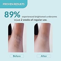 Fixderma Nigrifix Underarm Roll On 6% AHA 60ml — image 5