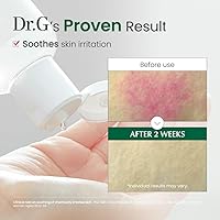 Dr.G RED Blemish Clear Soothing Korean Toner 300mL — image 5