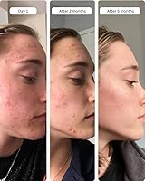 Averr Aglow Clear Skin Elixir — image 6