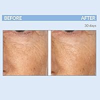 Serious Skincare Retinol Anti-Aging Skin Care Set — image 4