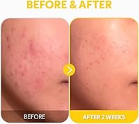 TIRTIR Pure Vitamin C 24% Face Serum 1.01oz — image 8