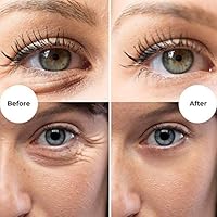 Gle Vitamin C Eye Serum for Dark Circles, Wrinkles & Redness — image 4