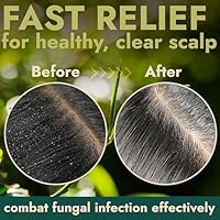 Terramed Tea Tree Scalp Scrub — image 4