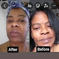 Vilót Skin Face Balm for Skin Barrier Repair 2.4oz — image 7