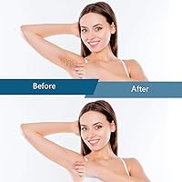 Bestidy Hard Wax Beads for Hair Removal - 1000g Blue — image 6