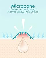 1HEROLABS Microdart Acne Patch (54 Patches) — image 2