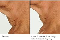 NassifMD Deco-Lift Neck Firming Complex Serum 5.29oz — image 4