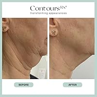 Contours Rx Neck Rescue Instant Correcting Strips, 30 Count — image 6