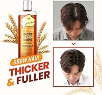 CRAZY SKIN German Beer Yeast Biotin Shampoo & Hair Treatment Set 300ml + 200ml — image 6