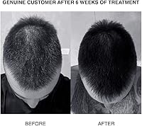 PATRICKS SH PLUS Ultra Thickening Shampoo 200mL — image 4