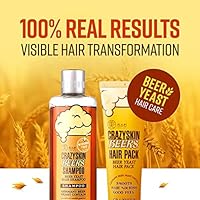 CRAZY SKIN German Beer Yeast Biotin Shampoo & Hair Treatment Set 300ml + 200ml — image 4