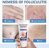 CIZHA Folliculitis Cream 60ml — image 5