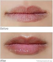 Dermelect Smooth Lip Volumizer — image 3