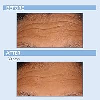 Serious Skincare Vitamin A Force XR Retinol Serum Concentrate 1 Oz — image 4