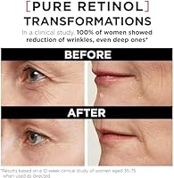 L'Oreal Paris Revitalift Triple Power LZR Retinol Night Serum 30mL — image 3