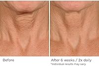 NassifMD Deco-Lift Neck Firming Complex Serum 5.29oz — image 5