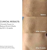 Evereden Golden Belly Serum 1.7oz — image 4