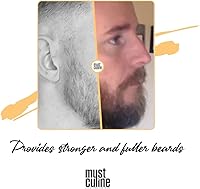 MUSTCULINE Beard Root Vitamin Spray 1.7oz Unscented — image 2