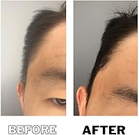 DPERM Down Perm Serum Concentrate Kit 120mL — image 6