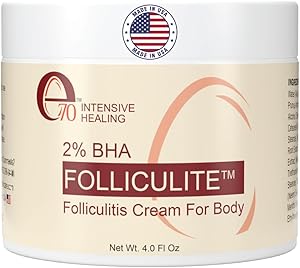e70 Folliculitis Cream – 4 oz Review