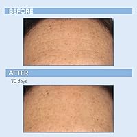 Serious Skincare Retinol Anti-Aging Skin Care Set — image 5