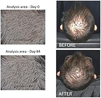 Actsyl-3 Anti-Aging Hair Serum 1.7 fl oz — image 4